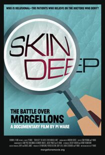 دانلود مستند Skin Deep: The Battle Over Morgellons 2019104233-1505140009